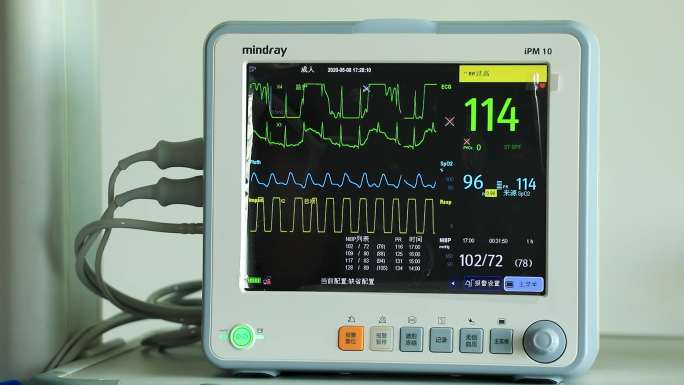 医疗器械 心电监护仪 心电图