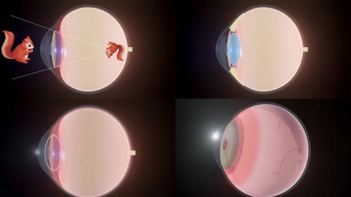 眼球结构近视动画科普解析眼睛晶状体视网膜