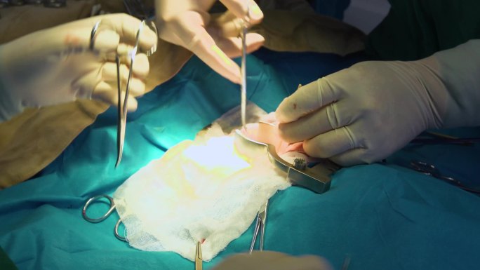 手术室 医生做手术 无菌环境