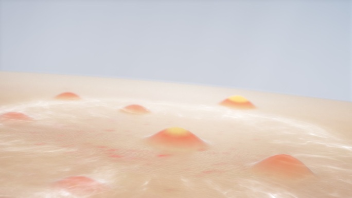 皮肤祛痘精华细胞水分子护肤