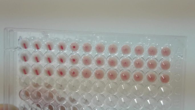 鸡新城疫 抗体滴度检测 实验结果