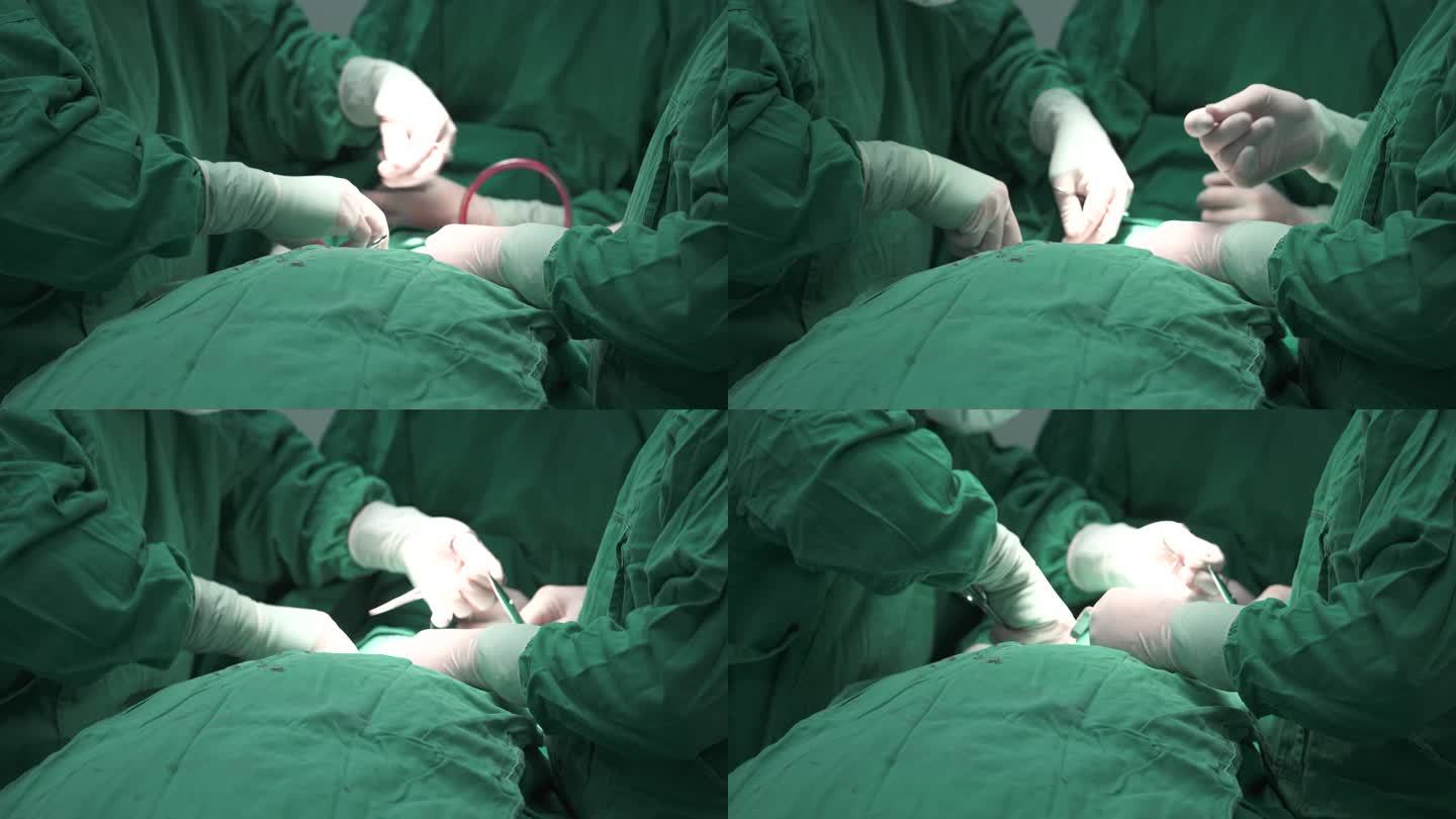 医院医生医疗视频素材4K-做手术