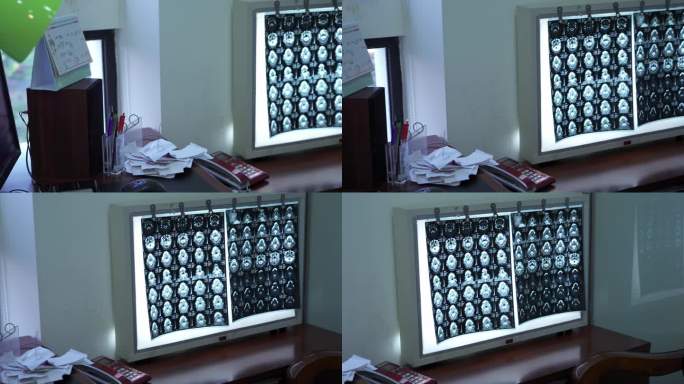 医院医生医疗视频素材4K-CT