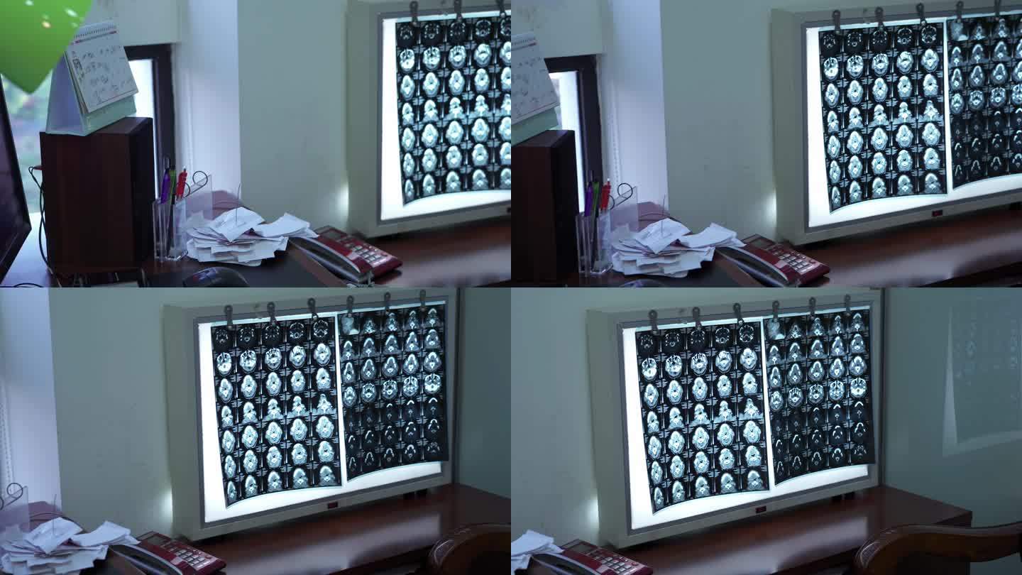 医院医生医疗视频素材4K-CT