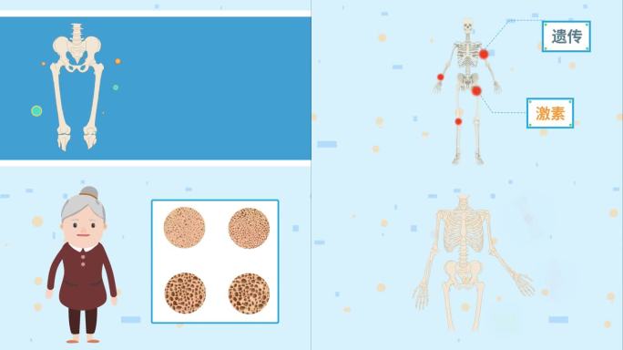 骨质疏松科普小知识