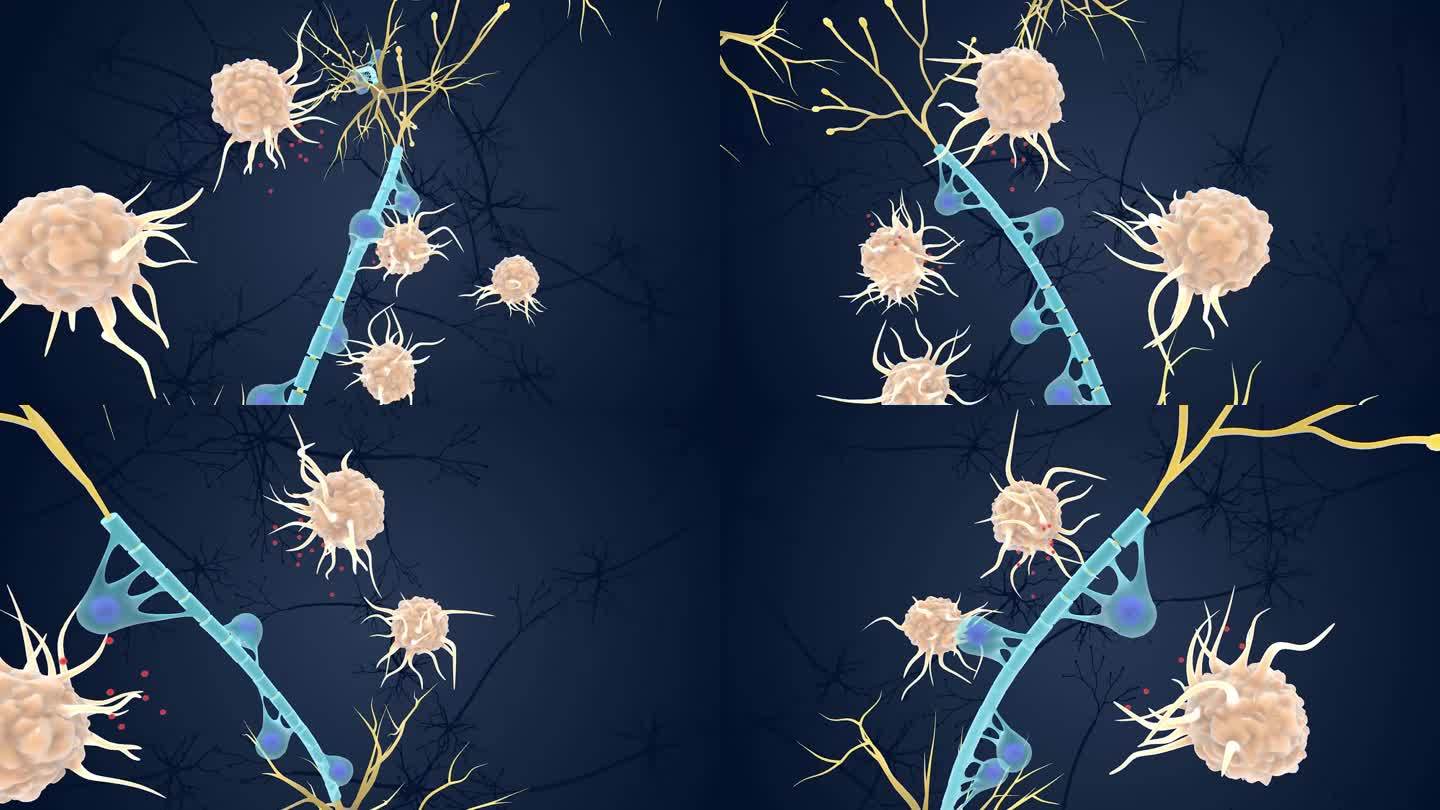 神经系统 树突 髓鞘 突触 轴突医疗动画
