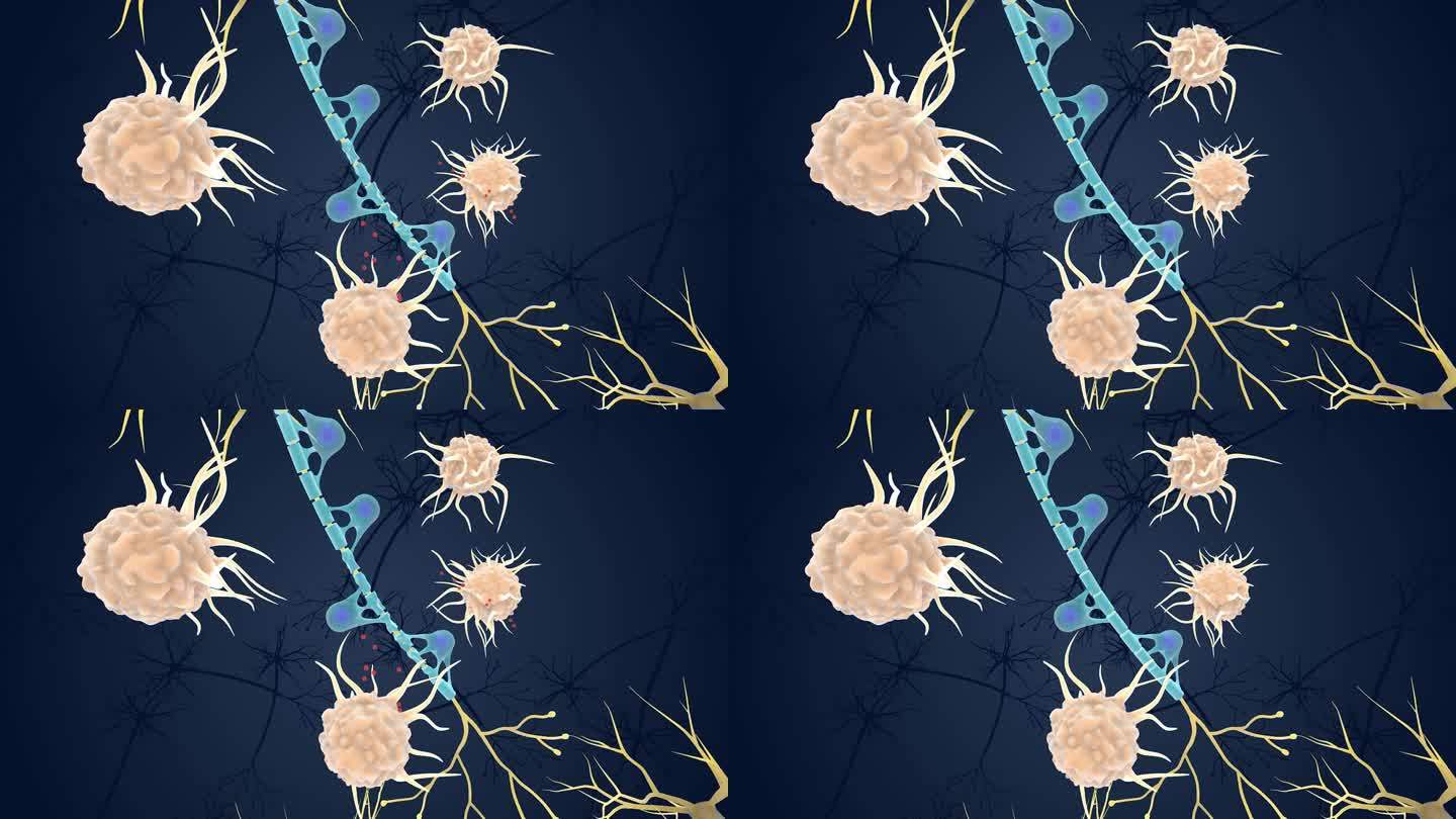 神经元 医学 医疗 髓鞘 免疫系统 动画