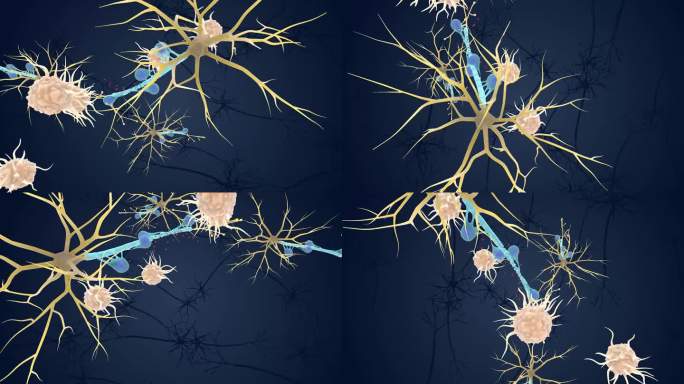 神经元 医学 医疗 髓鞘 免疫系统 动画