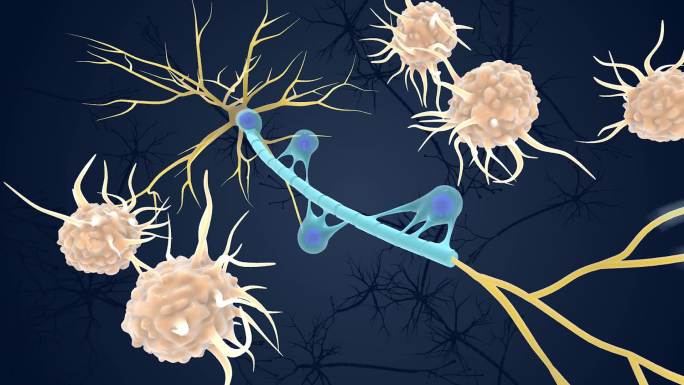 神经 免疫 系统 髓鞘 受到攻击医学动画