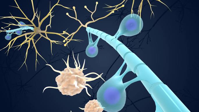 神经 免疫 系统 髓鞘 受到攻击医学动画