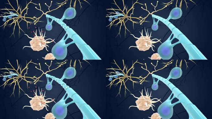神经 免疫 系统 髓鞘 受到攻击医学动画