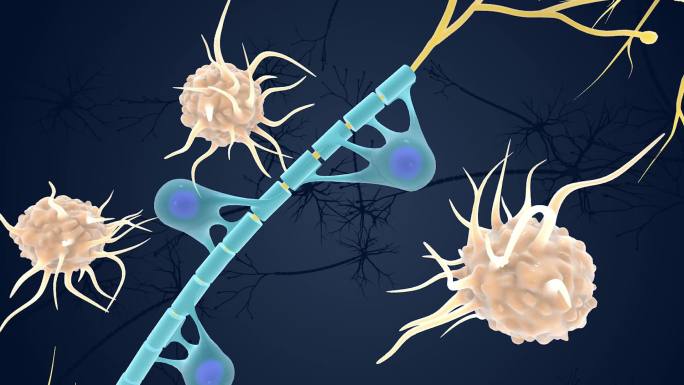 神经元 医学 医疗 髓鞘 免疫系统 动画