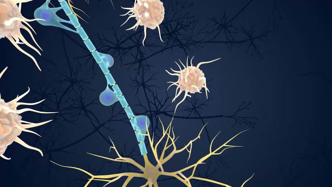 神经 免疫 系统 髓鞘 受到攻击医学动画