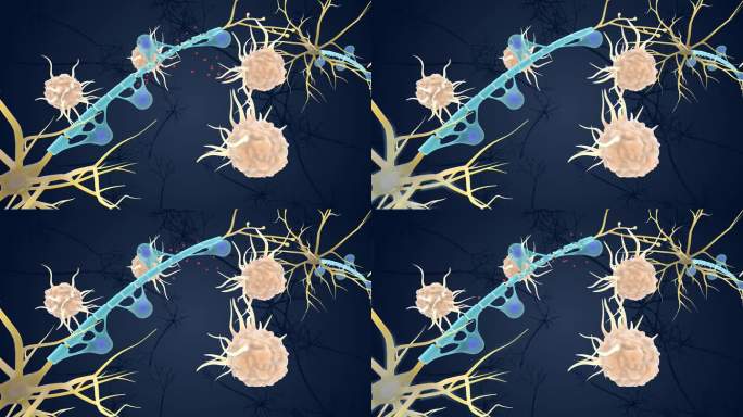 神经元 医学 医疗 髓鞘 免疫系统 动画