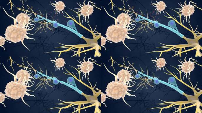 神经 免疫 系统 髓鞘 受到攻击医学动画