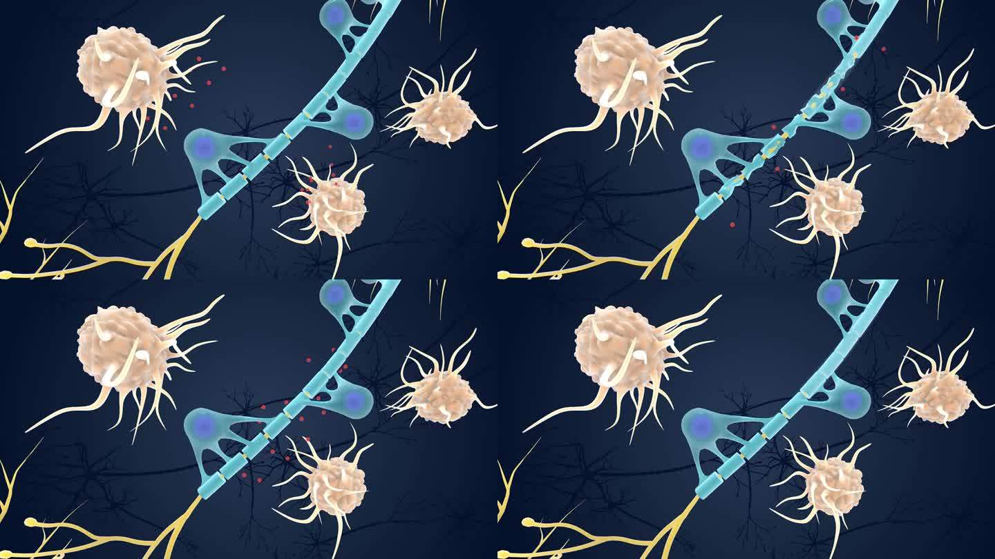 神经 免疫 系统 髓鞘 受到攻击医学动画