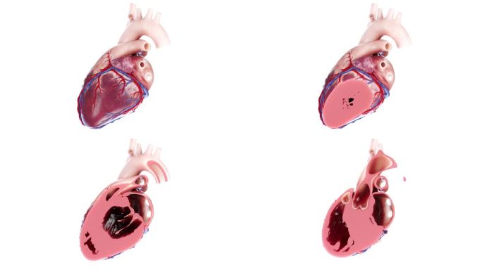 医学人体器官 全息 幻影成像 心脏动画