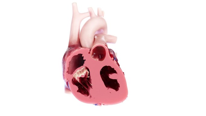 医学 医疗 心脏 解剖 剖面 三维 动画