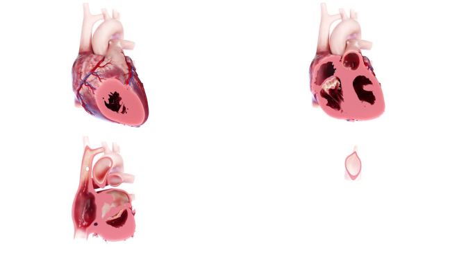 医学 医疗 心脏 解剖 剖面 三维 动画