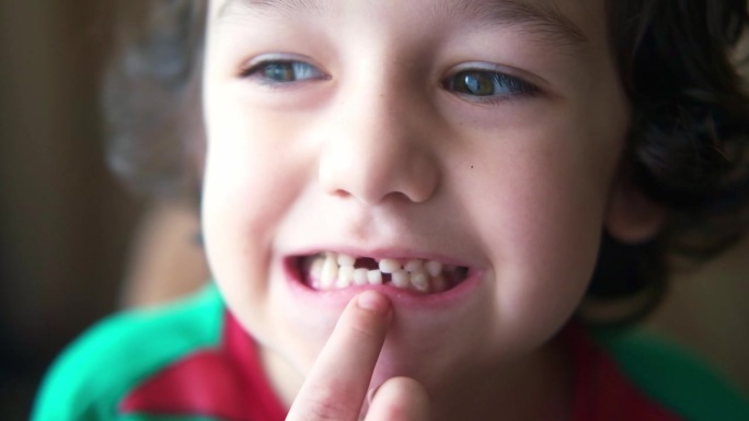 一个小卷发男孩露出一颗松动的乳牙。