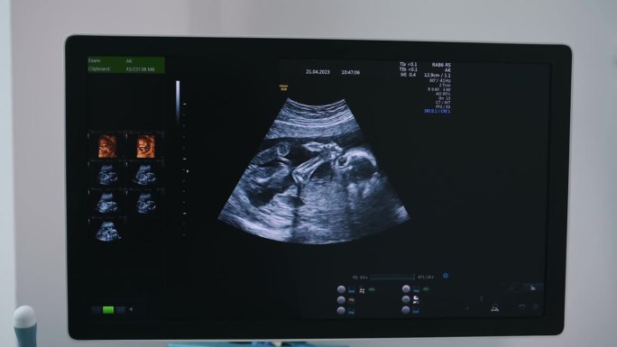 孕妇婴儿超声显示。保健的概念。