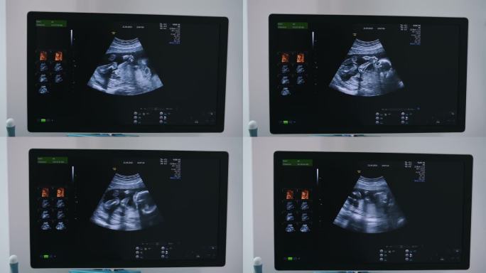 孕妇婴儿超声显示。保健的概念。
