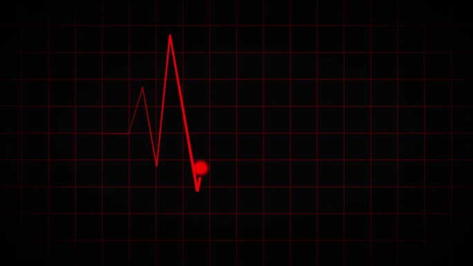 心电图示波器的红色屏幕。心跳监测仪在心电图线监测仪上显示一个连续循环的心电图医学屏幕，在黑色背景上显