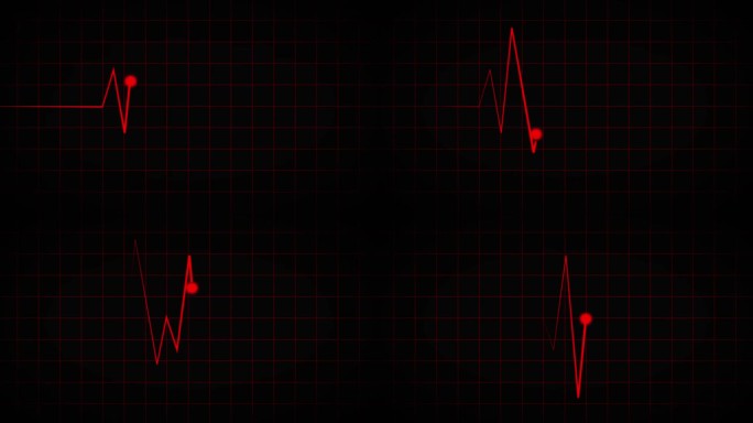 心电图示波器的红色屏幕。心跳监测仪在心电图线监测仪上显示一个连续循环的心电图医学屏幕，在黑色背景上显