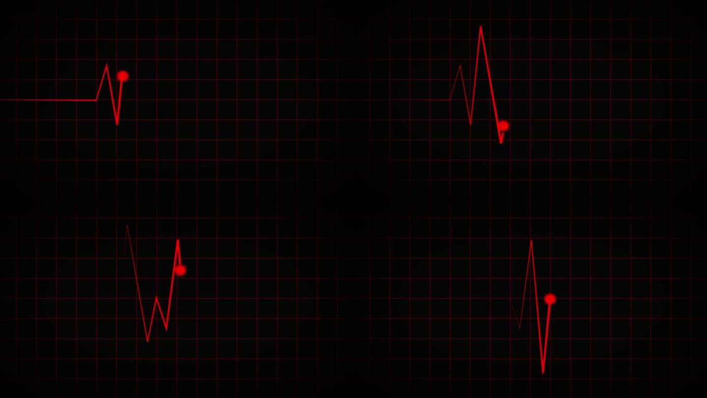 心电图示波器的红色屏幕。心跳监测仪在心电图线监测仪上显示一个连续循环的心电图医学屏幕，在黑色背景上显