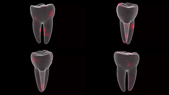 3D牙齿旋转。牙痛扫描接口。HUD牙齿分析。医学解剖学概念。数字牙齿解剖模型。口腔保健理念。用于标题
