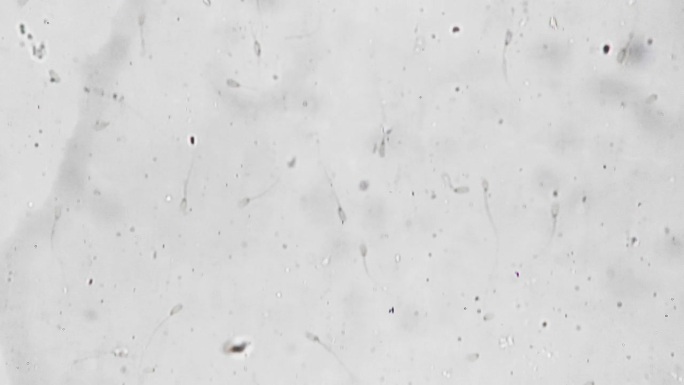 精子涂片样品的微距镜头在显微镜下放大400倍，并在实验室研究