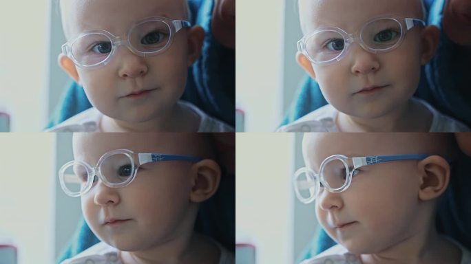 一岁大的斜视婴儿戴着眼镜看着镜头。白种人婴儿有斜视，视力不佳或视力不良。患有眼疾的孩子。特写，小女孩