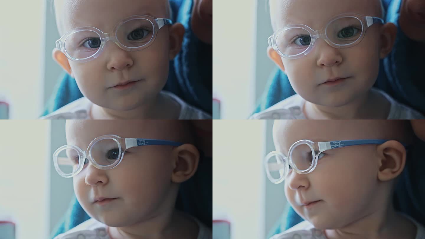 一岁大的斜视婴儿戴着眼镜看着镜头。白种人婴儿有斜视，视力不佳或视力不良。患有眼疾的孩子。特写，小女孩