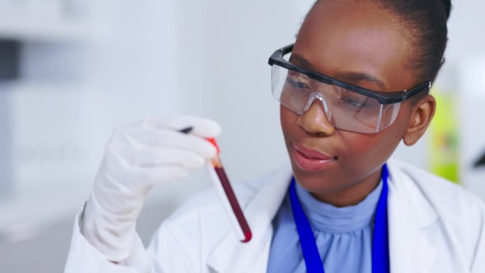 血液测试，研究和科学家妇女与试管分析，疫苗和愉快的保健结果在实验室。医学，科学博士或非洲人微笑红色试