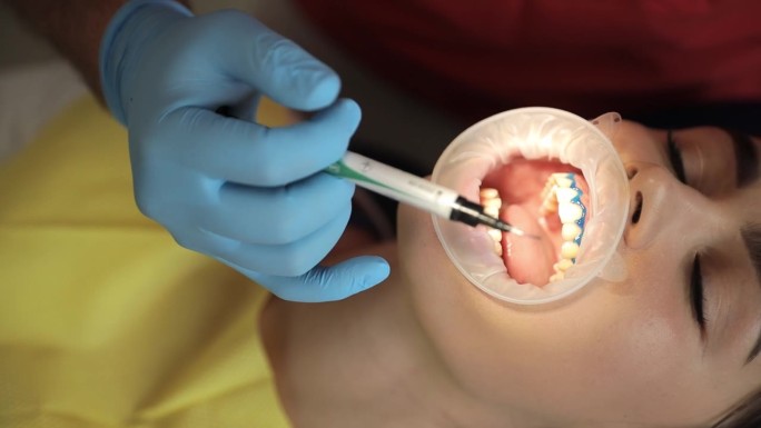 牙医用现代方法进行牙齿美白。治疗和美白牙齿