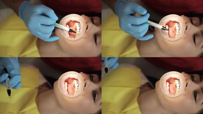 牙医用现代方法进行牙齿美白。治疗和美白牙齿