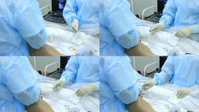 射频消融下肢静脉经验丰富的静脉学家