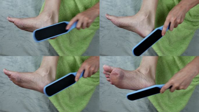 雌性用磨砂刷去脚上的角质。女性脚后跟破裂的治疗。一名妇女用塑料磨碎器对脚跟皮肤进行整容手术。愈伤组织