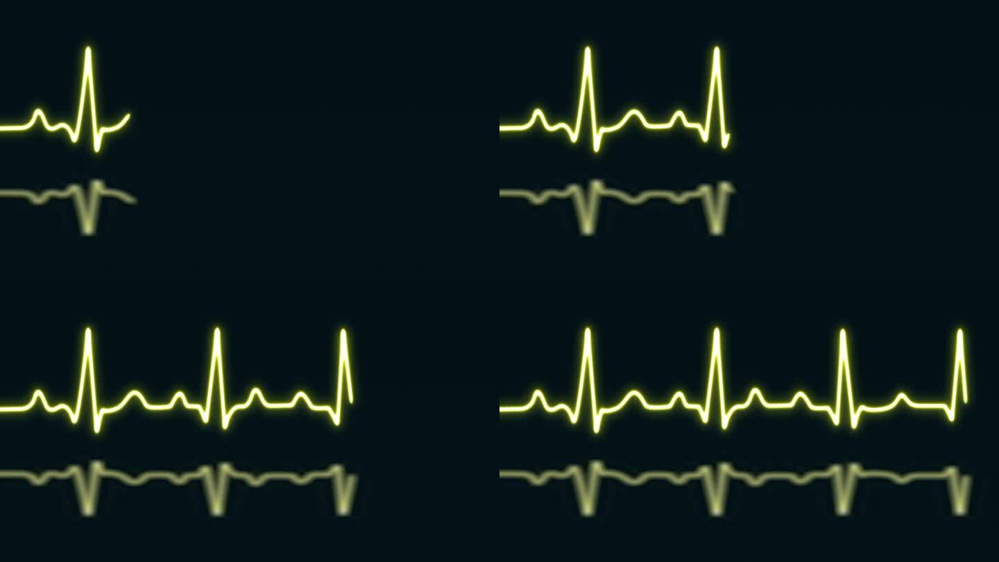 黄色霓虹心跳与爱的形状孤立在蓝色网格背景。医学概念和心电脉搏曲线图