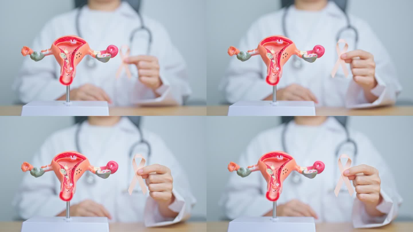 9月子宫癌宣传月，医生手持带有子宫和卵巢模型的桃丝带。子宫内膜异位症、子宫切除术、子宫肌瘤、生殖、保