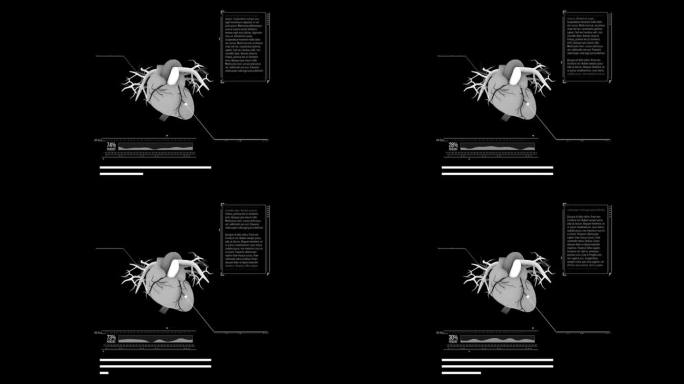 解剖正确的数字人类心脏无缝循环。未来粒子心脏计算机断层扫描与旋转循环3D渲染。MRI的未来，疾病，健