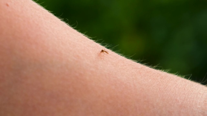 蚊子叮人的手以致人死亡。有选择性的重点。大自然。