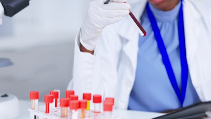 女科学家，用于研究检查的剪贴板和血液试管，疫苗数据和实验室清单。医疗保健、医务人员和科学人员进行药物