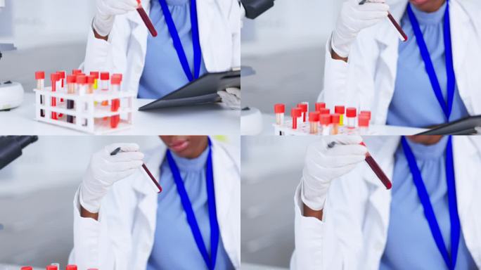 女科学家，用于研究检查的剪贴板和血液试管，疫苗数据和实验室清单。医疗保健、医务人员和科学人员进行药物