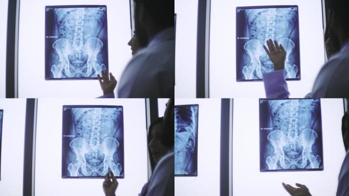 骨科/ x射线胶片分析