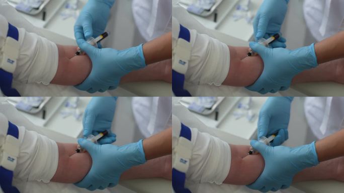 戴着蓝色医用手套的无法辨认的女性实验室助理在医学实验室采集血样或患者静脉样本的特写俯视图。