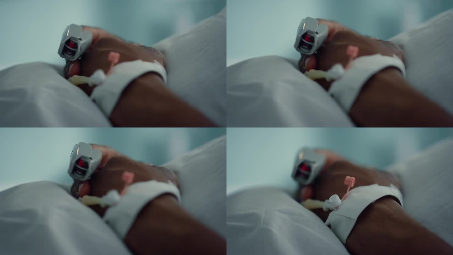 病人手指脉搏监测装置特写。男性手上有医用导尿管