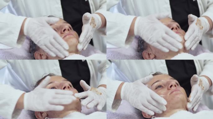 在美容诊所接受补水手术的女性客户，在油性痤疮皮肤上涂抹保湿霜的特写
