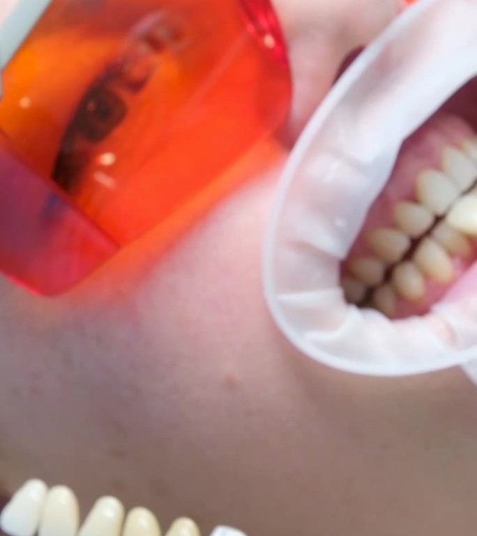 经典牙齿着色用于确定牙齿颜色Banner牙齿美白，牙齿近距离用色块引导漂白颜色，女性贴面微笑，口腔保