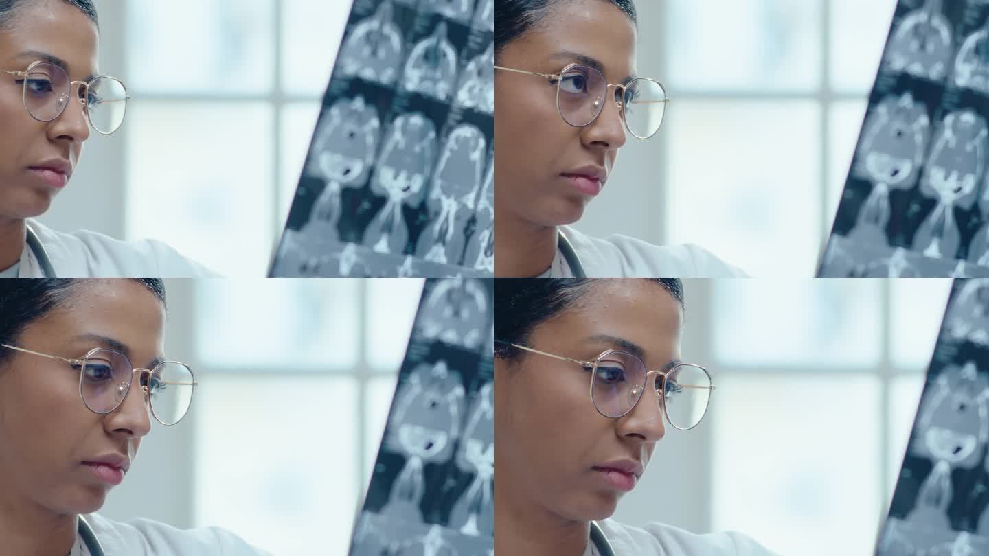 女医生在临床检查脑部CT扫描